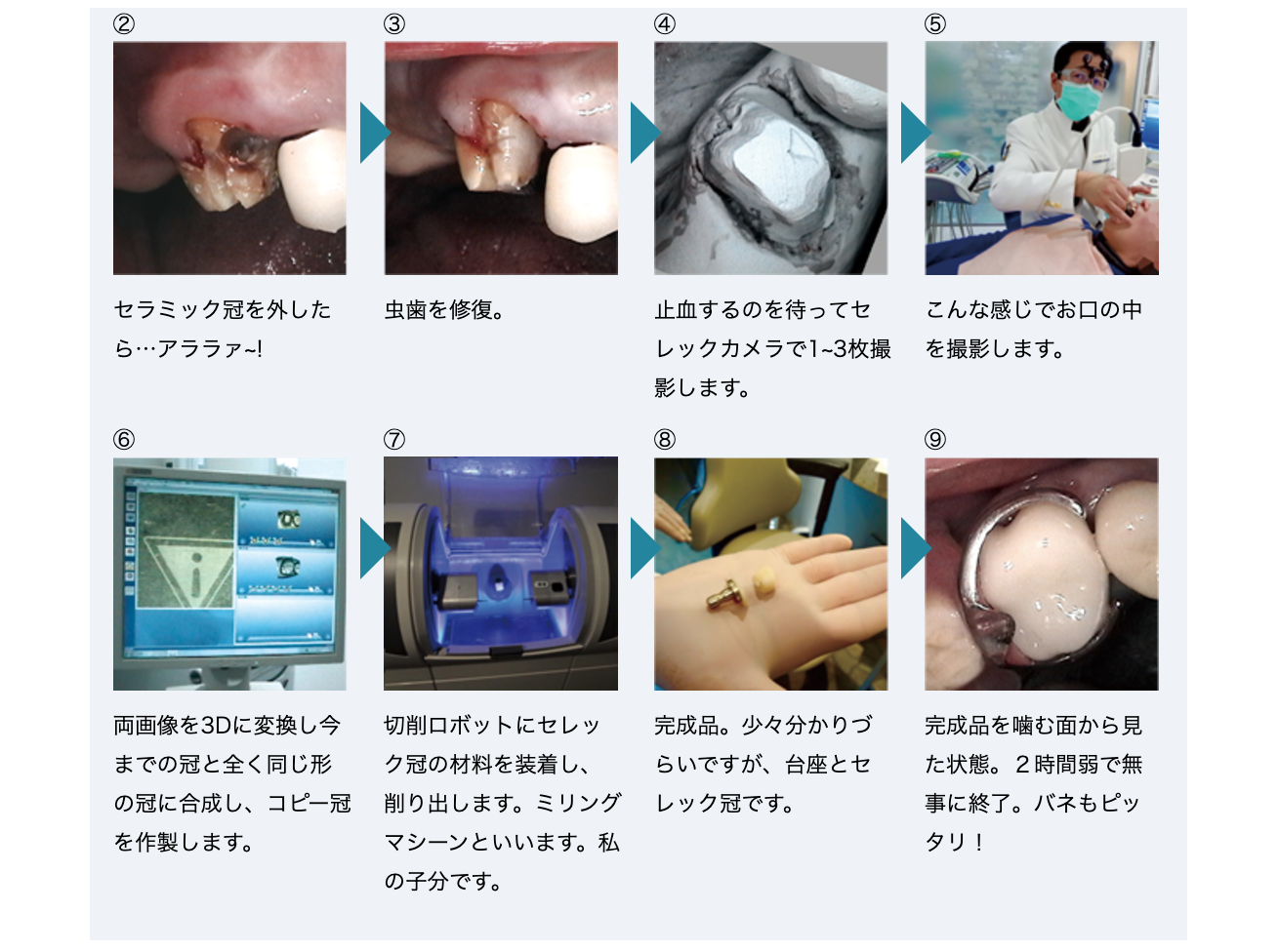 患者様に短時間で審美性と機能性を兼ね備えた歯を提供する革新的な技術です