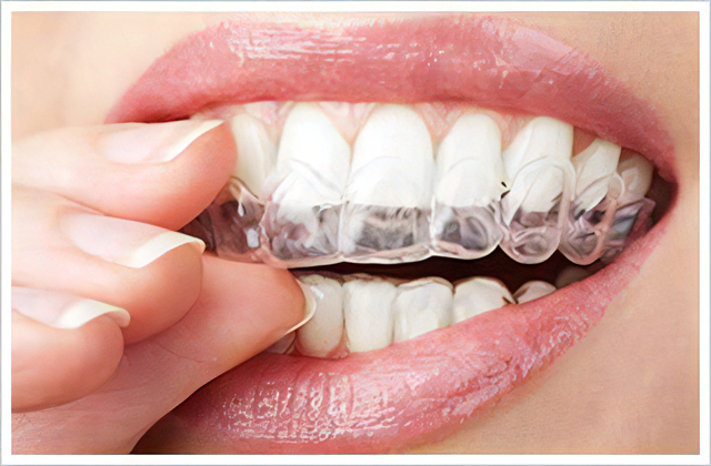 矯正歯科治療を提供