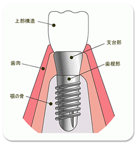 天然歯に限りなく近い人工歯