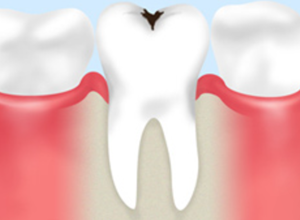 精密な治療で歯の寿命を延ばし、健康な口腔環境を維持します