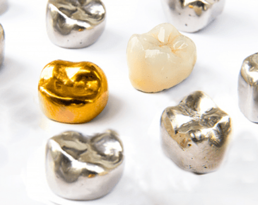 患者様のご希望に叶う補綴を提案させていただきます