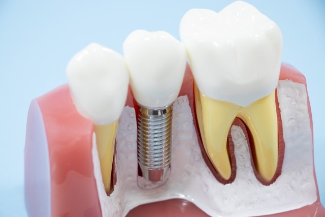 写真はイメージです