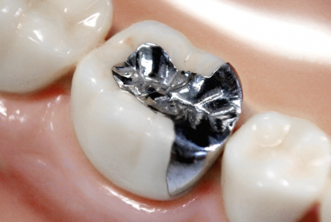 気になる見た目を自由に選択できるようご用意します