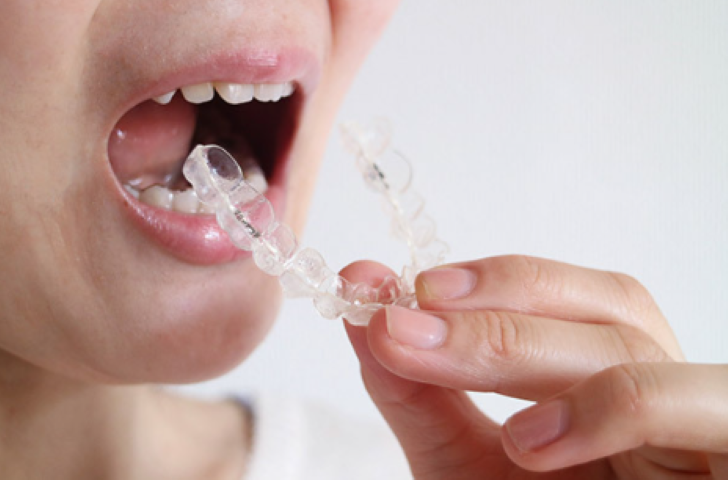 白川歯科医院の矯正歯科で理想の笑顔を