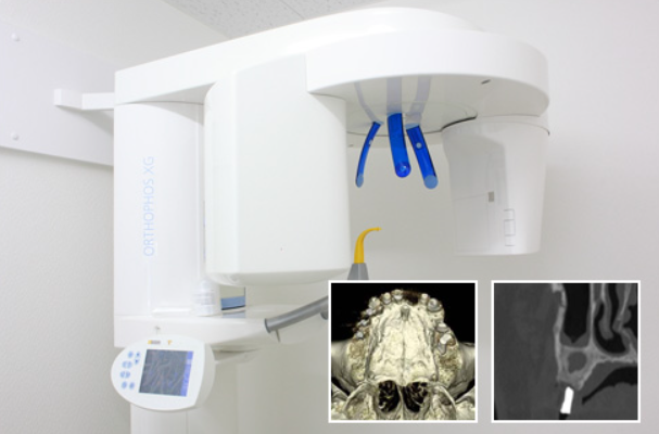 歯科用CTを導入しています