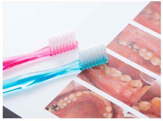 一生涯自分の歯で暮らせるサポートを致します