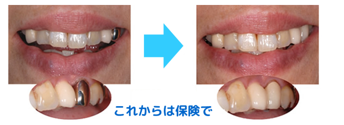 一部の治療は保険適用で行えます