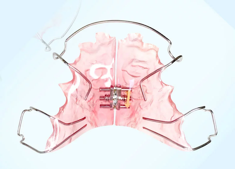 歯列の悩みを丁寧にサポート