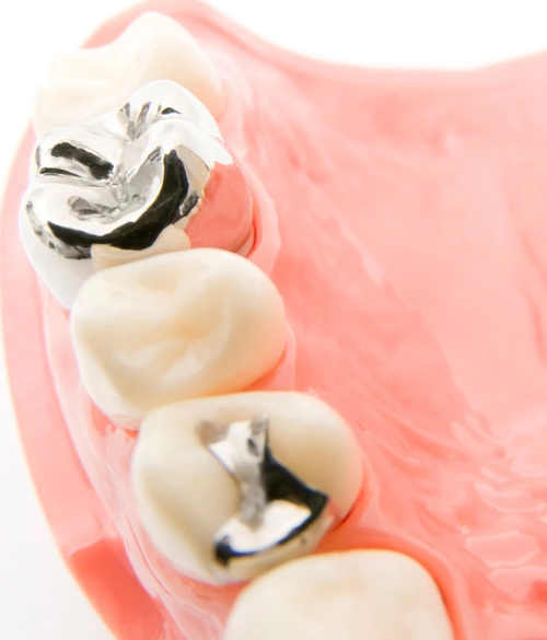 痛みの少ない治療を行っております。