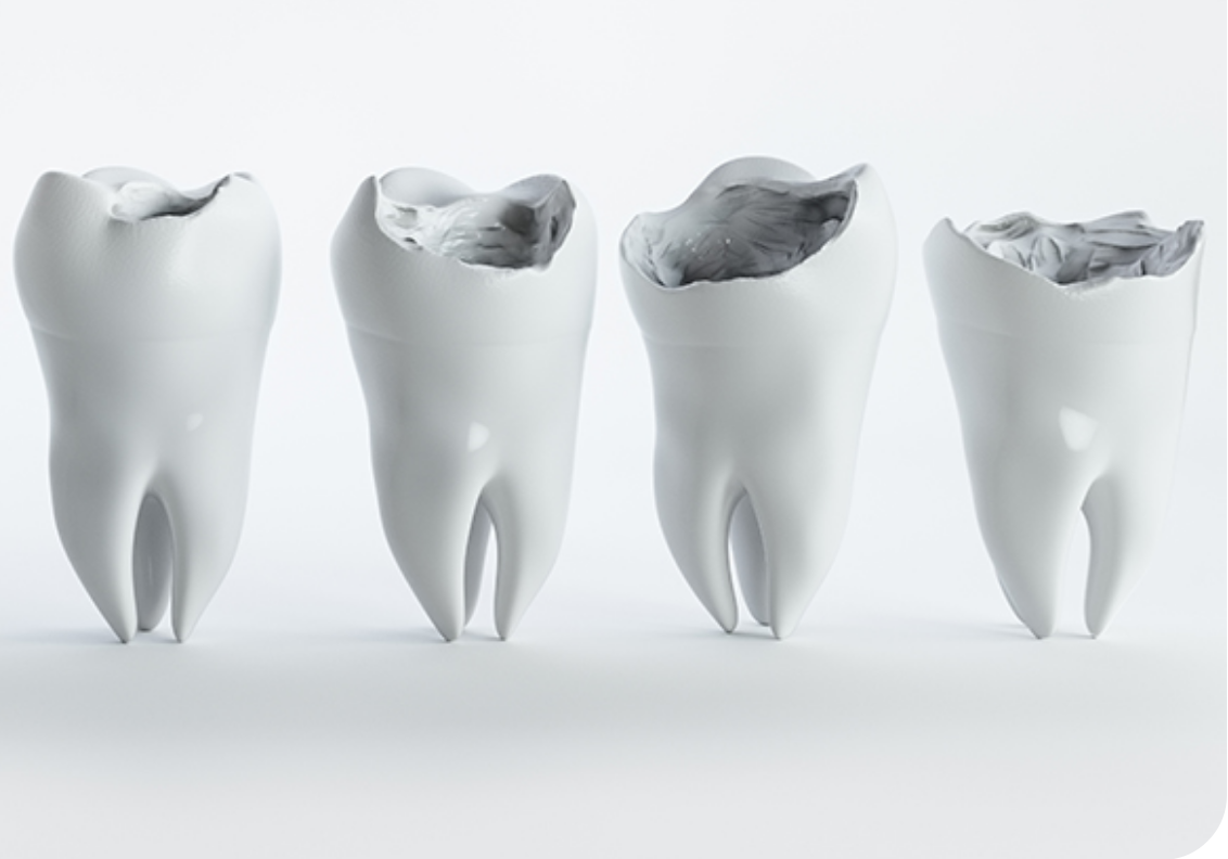 治療後も再発しないよう、定期的なメンテナンスをおすすめします。