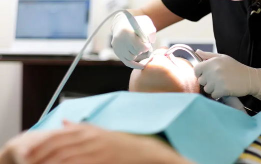 短時間でホワイトニングできます