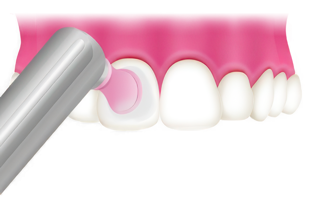 メンテナンスがとても大切です。