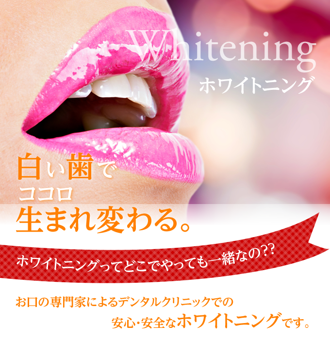 ホワイトニングを通じて患者様の明るい笑顔づくりをお手伝いしています