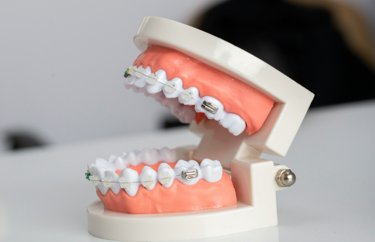 認定医による安心の歯列矯正を提供しています。