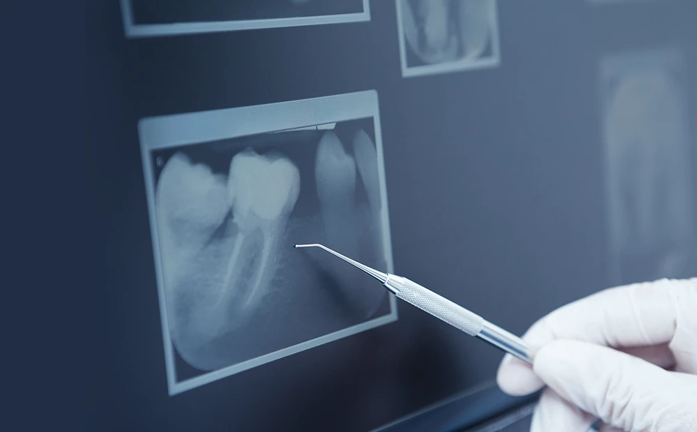 お口周りで気になることがありましたらご相談ください