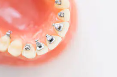 表面からは見えません