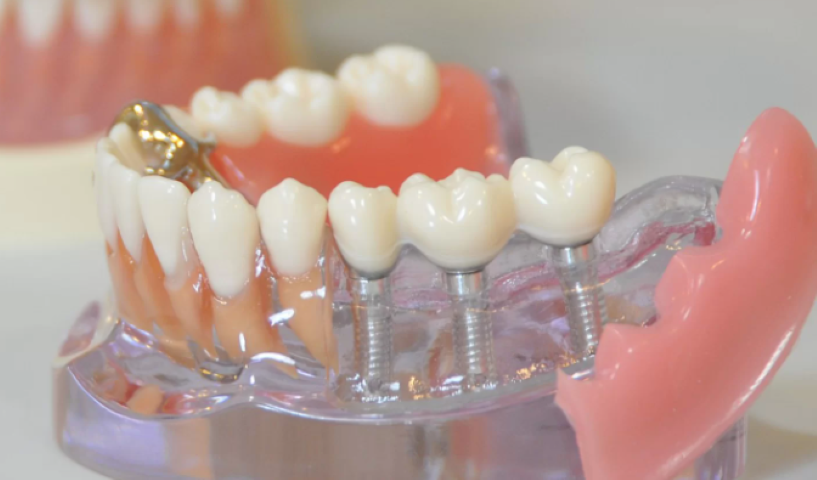 自然な笑顔と機能性を両立