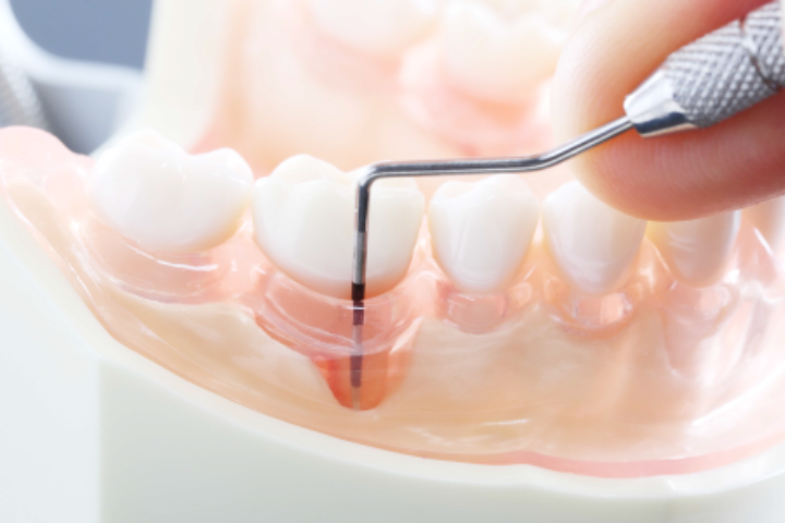 メンテナンスで健康な口元を長く維持していきましょう