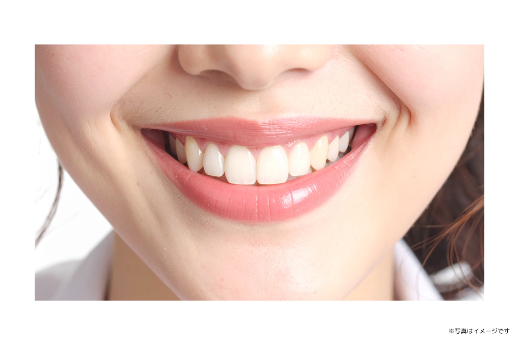 専属の歯科技工士が直接歯の色調を確認して調整しています