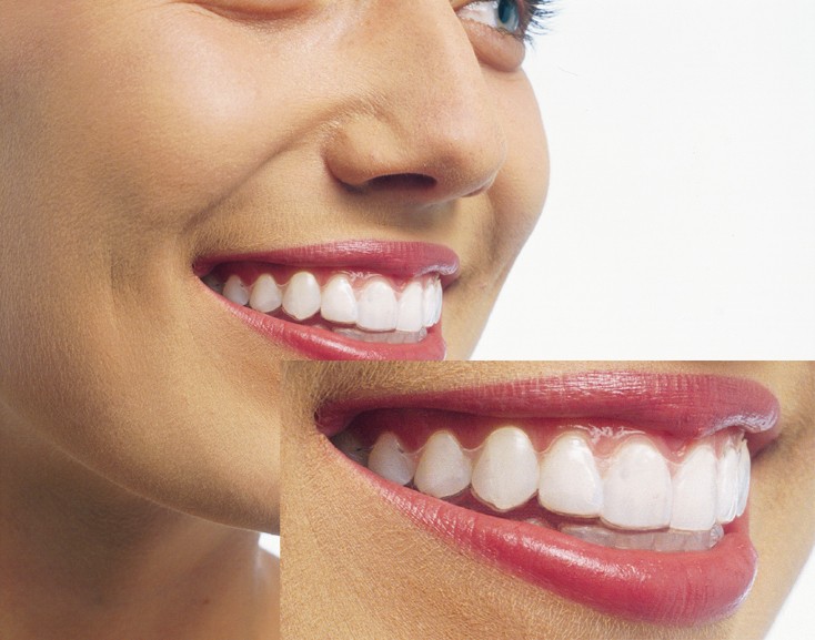 矯正治療を中心にさまざまな治療を行っています