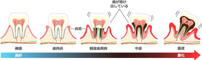 歯周病対策の治療できます