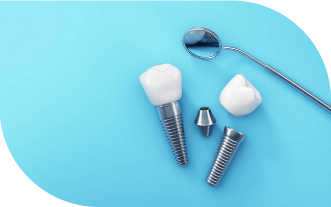 インプラントオーバーデンチャーの制作も可能