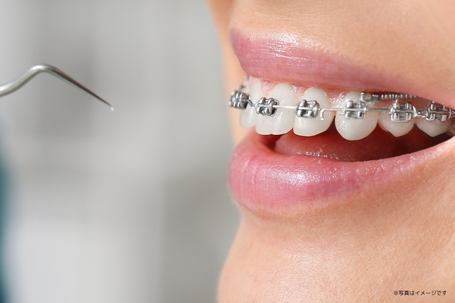 患者様の年齢や状態に応じた矯正治療を行い、口元の美しさと機能性を兼ね備えた歯並びを目指します