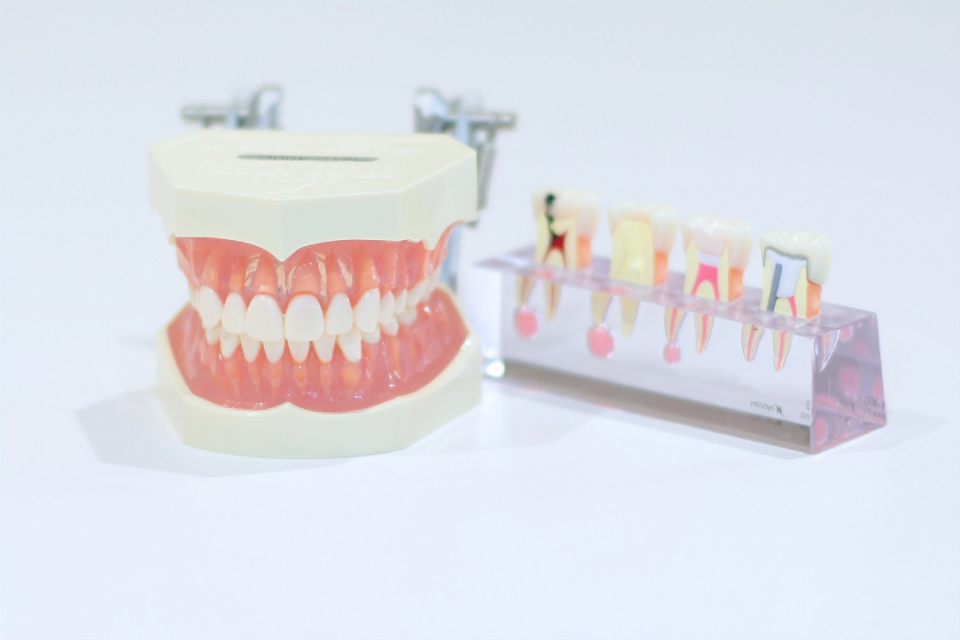 有床義歯治療を提供