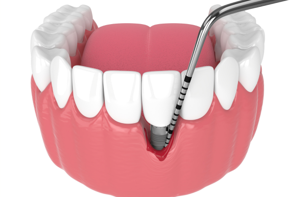 ※画像はイメージです