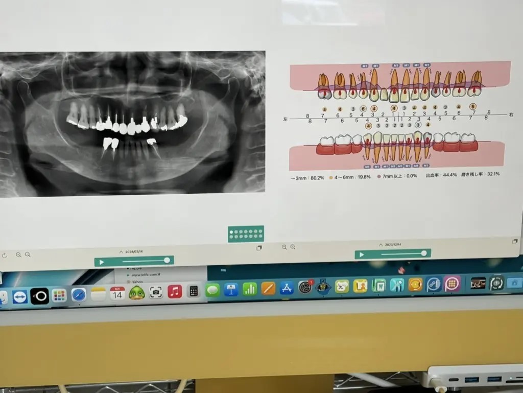 カウンセリングルームにてお口の状態や治療計画をお伝えしています