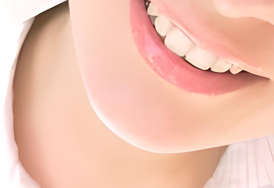 ポーセレンベニアとホームホワイトニングで自然な美しさを手に入れる