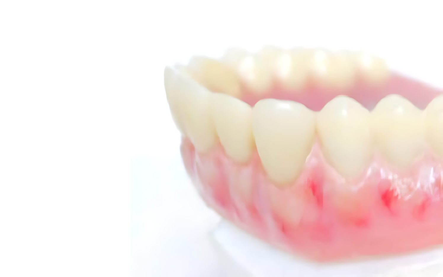 審美性と機能性を考慮した快適な義歯で咀嚼機能を回復