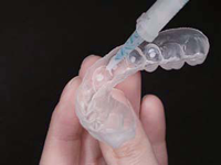 ホームホワイトニングのイメージです。