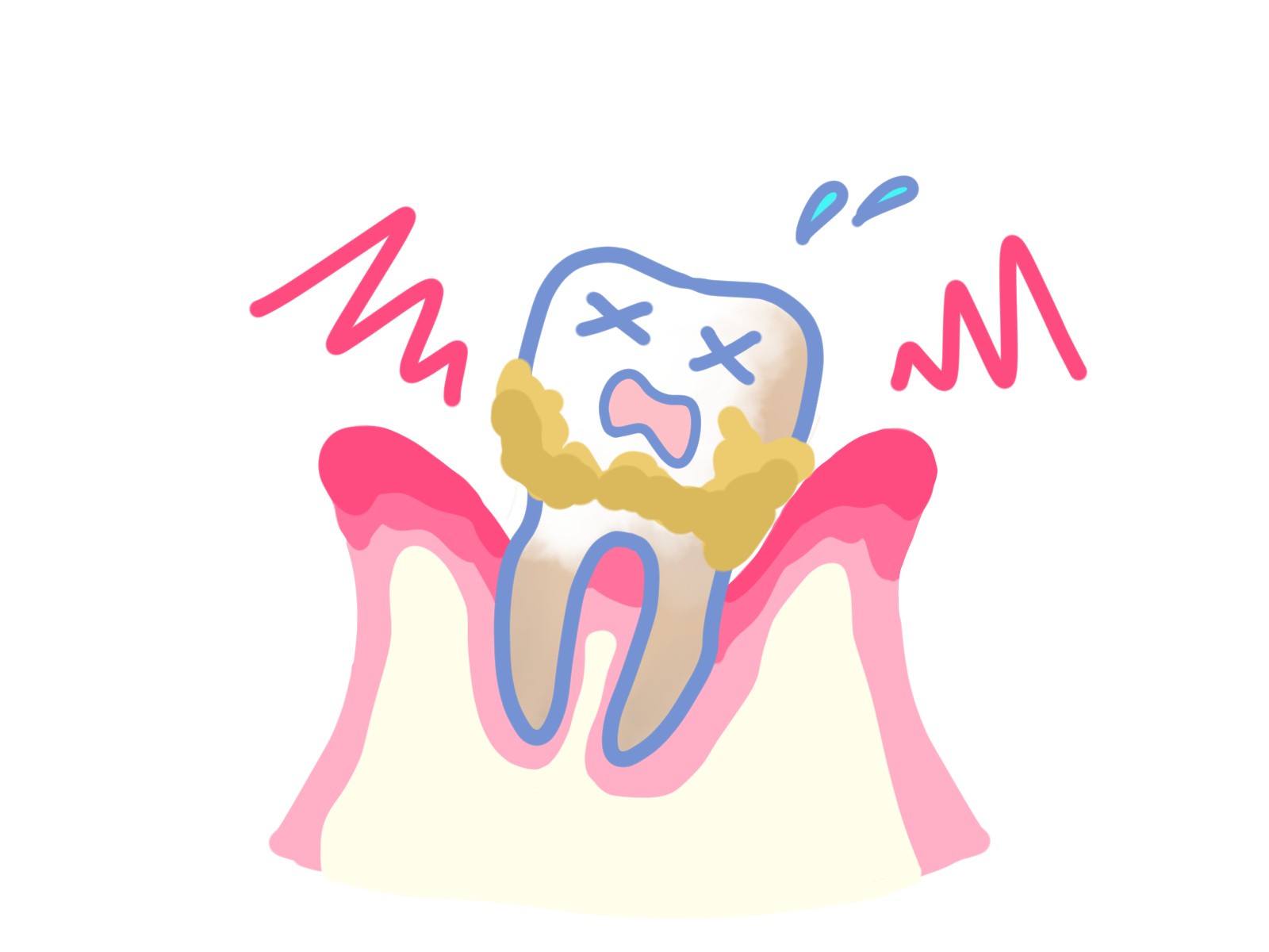 継続的なケアにより、歯周病の再発予防と健康維持を目指します。