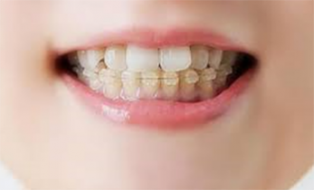 見た目の美しさにも配慮した治療で、自然な笑顔を引き出す