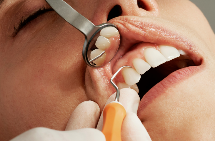 身近な歯のトラブルに対応する一般歯科治療