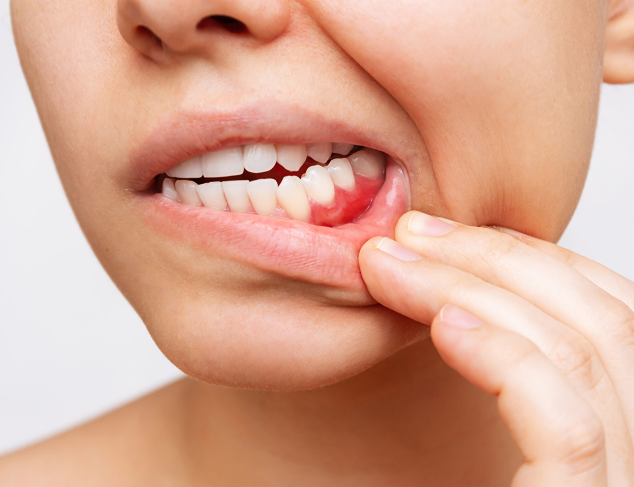 全身の健康にも影響する歯周病を早期撃退