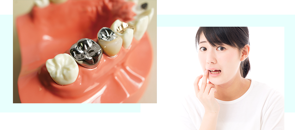 白い被せ物や詰め物を院内で最短2時間で作製・装着可能です