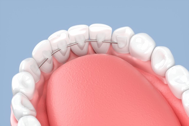機能回復と見た目の調和を両立した矯正治療を提供し、日常生活への負担を抑えながら理想的な歯列へ導くことを目指しています。※写真はイメージです。