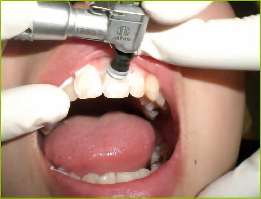 PMTCをおすすめします