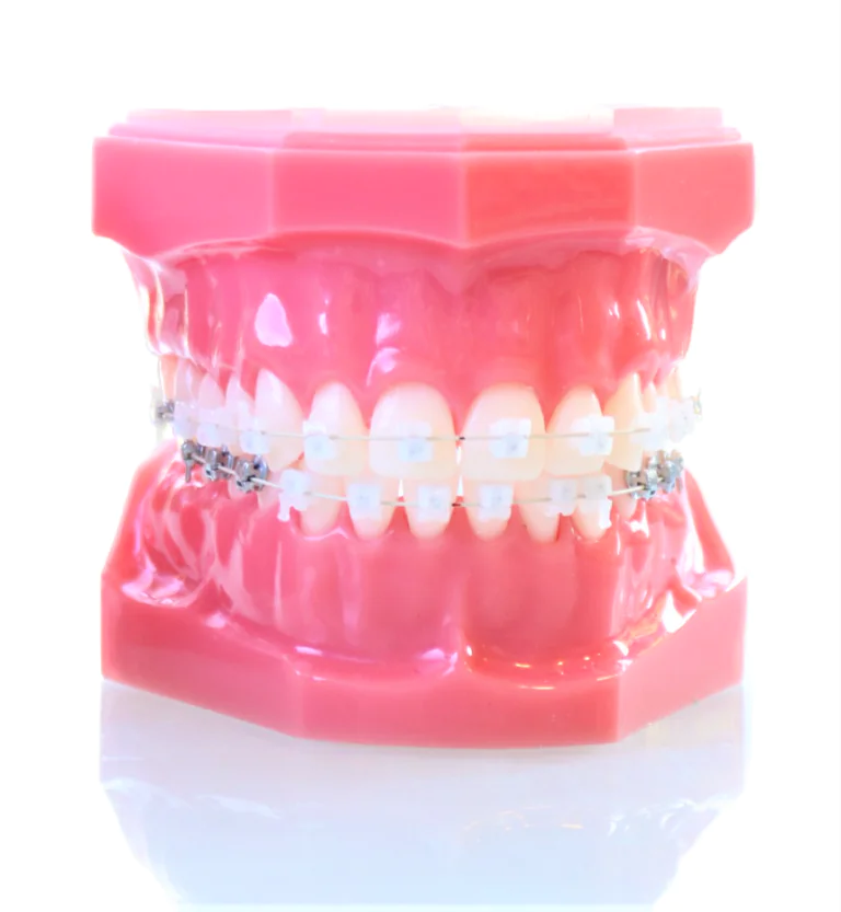 歯並びを整えるだけでなく、舌や筋肉のバランス、呼吸のしやすさまで考慮した治療を行っています