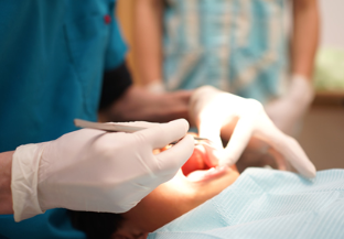 ご自身の歯を大切にしていきましょう