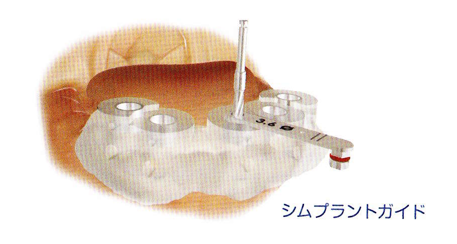 シムプラントというシミュレーションソフトを導入