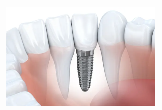 治療後のフォローアップにも対応しています