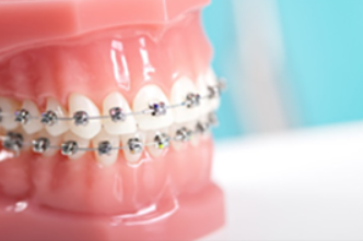 歯並びにお悩みの方はご相談ください