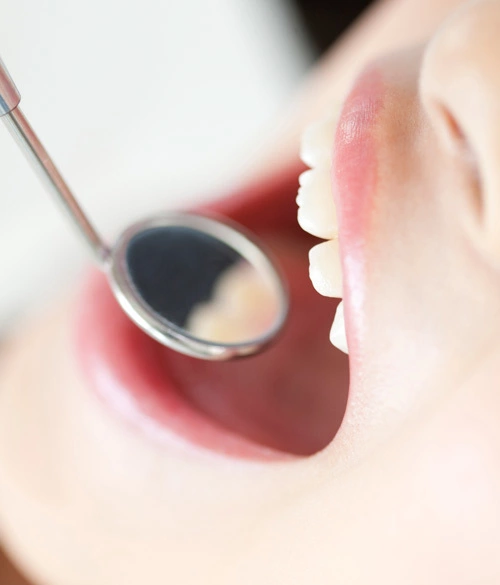 審美歯科は機能性だけでなく見た目にもこだわる治療法です。