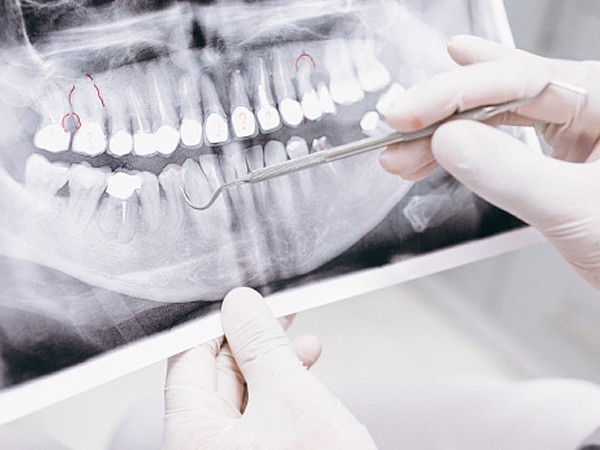 原因を分析しましょう