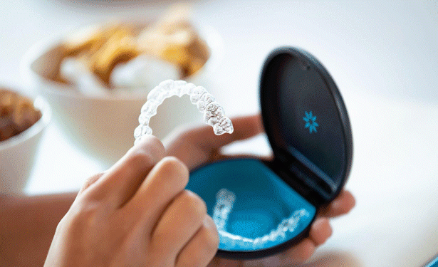 透明で取り外し可能なマウスピースを使用した矯正治療が提供されています