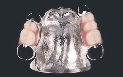 保険・自費の両面から、納得の義歯づくりをサポート