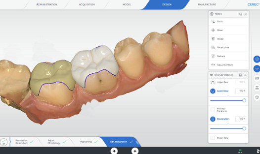 自然な白さと形を追求した高品質なセラミック